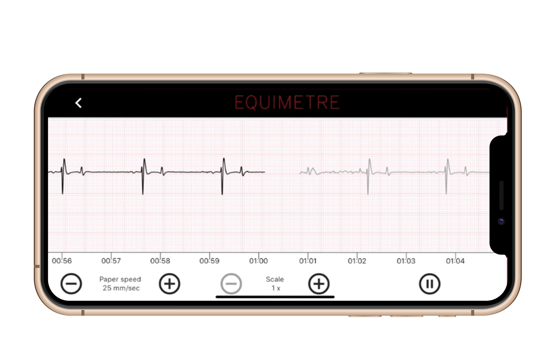 ecglive ECG LIVE