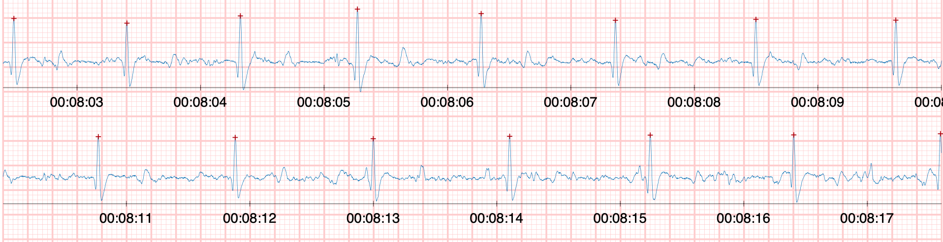 ecg cheval normal ecg cheval