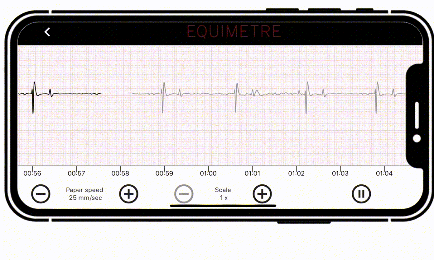 Copie de Copie de GIF PLATEFORME SITE WEB gif of an ecg in real time live