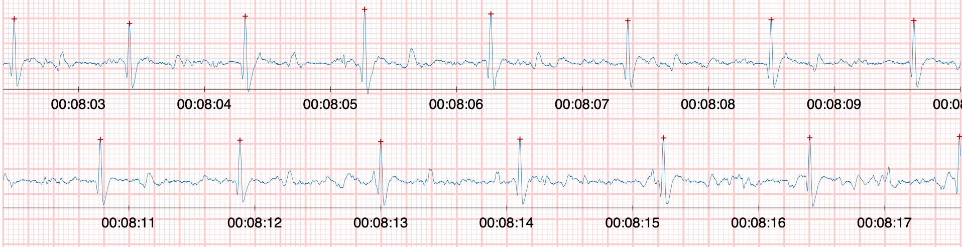 ECG du cheval
