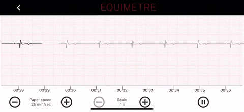 Equimetrevet-GIF-downsized_large ECG du cheval