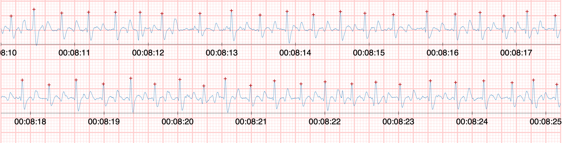 ECG du cheval
