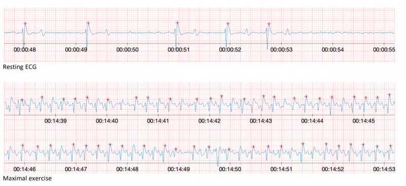 Rapport ECG Rapport de l'ECG proposé par l'Equine Sport Medecine Practice