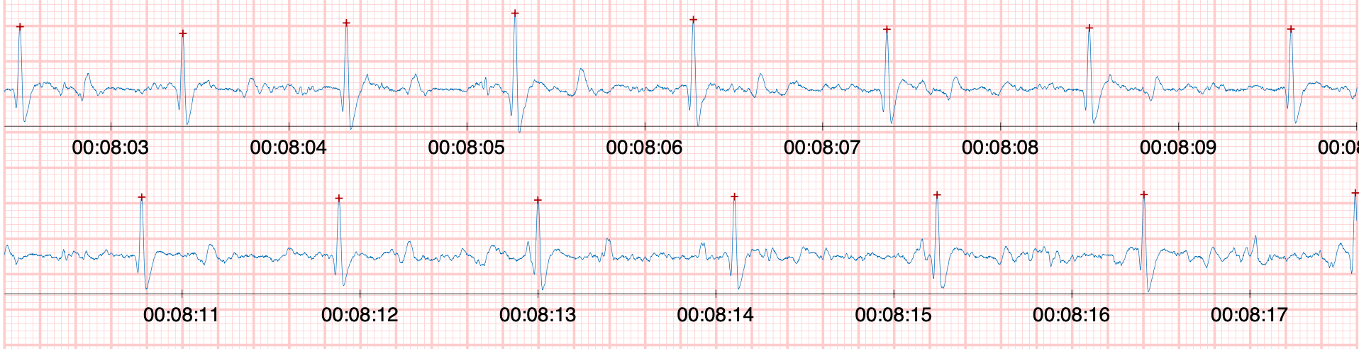 pas-pb (1)